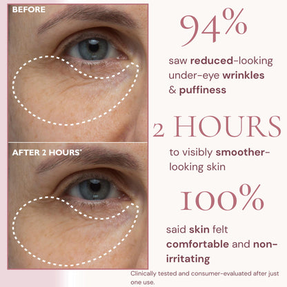 Peptiject™ Peptide-Infused Face & Eye Tape