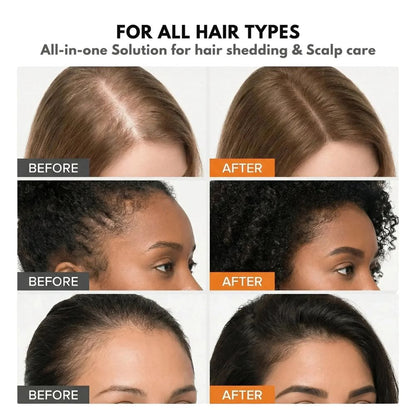 Korea's Best-Selling Hair Growth Serum