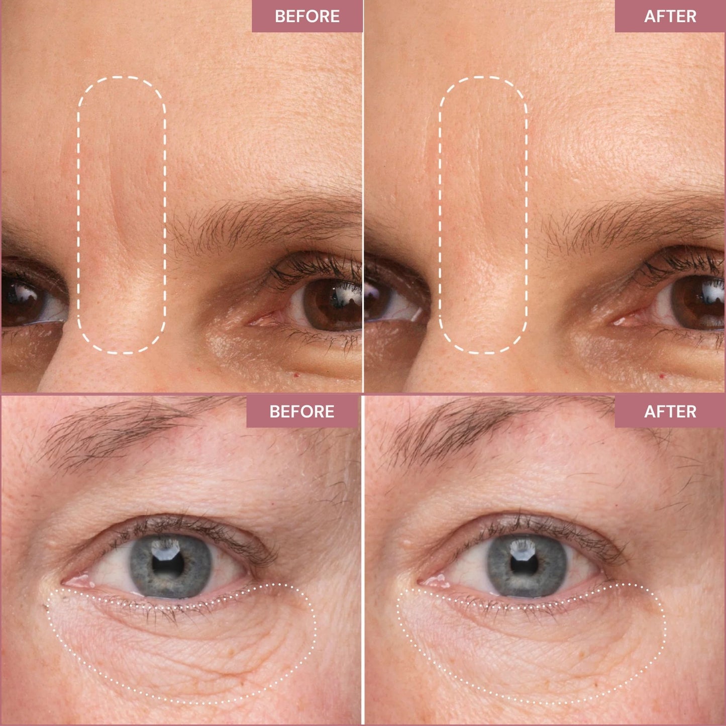 Peptiject™ Peptide-Infused Face & Eye Tape