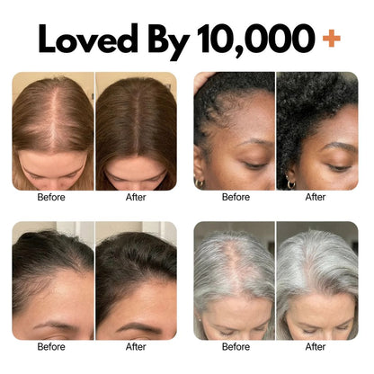 Korea's Best-Selling Hair Growth Serum