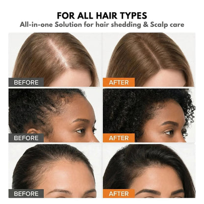 Korea's Best-Selling Hair Growth Serum
